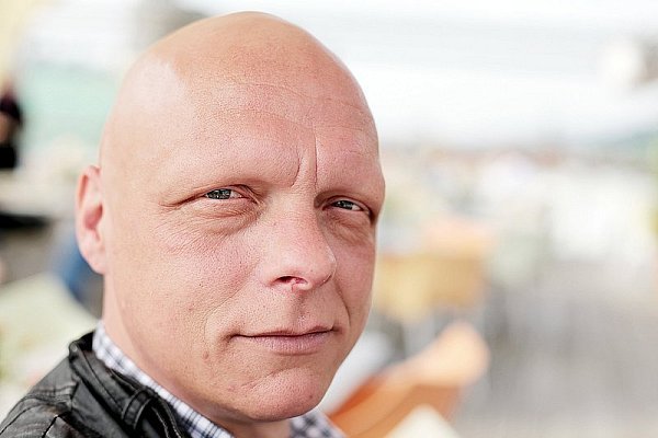 Dirk van der Ven, früher Fußballprofi bei Arminia Bielefeld, verlor innerhalb weniger Wochen sämtliche Haare. - © FOTO: REIMAR OTT