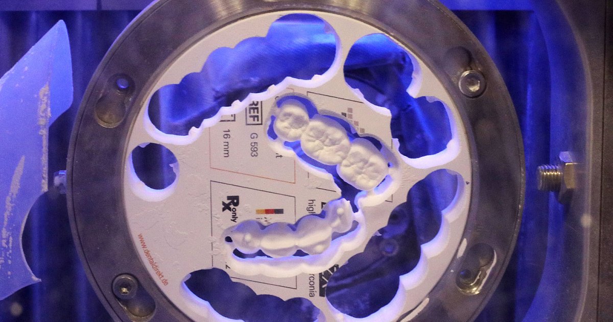 Breite Zustimmung zur DentalDirektErweiterung im Spenger Rat nw.de