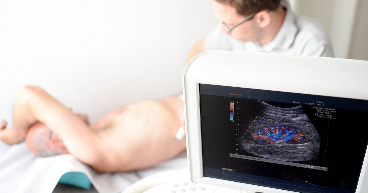 Fast-800-Millionen-Menschen-mit-chronischer-Nierenkrankheit