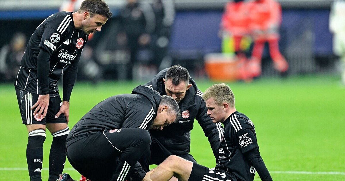 Eintracht-Engpass-im-Sturm-Sorge-um-Burkardt