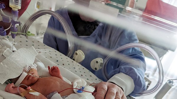 13 Wochen zu früh kam Erling zur Welt. Er wog nur 990 Gramm. - © Klinikum Herford
