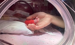 Ein Moment, der zu Herzen geht: Zera Chaer, Mutter der nach 26 Schwangerschaftswochen geborenen Nora, hält durch ein Fenster im Inkubator das Füßchen ihrer Tochter ganz vorsichtig in der Hand. Die Frühgeborene spreizt ihre winzigen Zehen. - Matthias Bungeroth