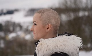Julia Fischer ist angehende Physiotherapeutin. Sie hat ihr Schicksal angenommen. Ihr Freund Kilian Kunz rasierte ihr die wenig verbliebenden Haare zu einer Glatze. - Privat/Julia Fischer