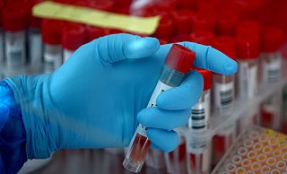 Zweifel an der Gültigkeit einer unbekannten Zahl von PCR-Testergebnissen müssen unbedingt ausgeräumt werden. - LISI NIESNER