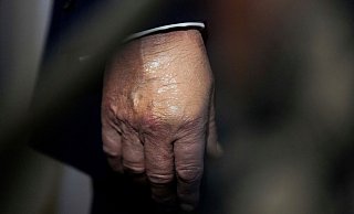Nachdem der Bluterguss am Handrücken für Aufsehen sorgte, wurde er häufig bei Auftritten zugeschminkt. (Archivbild) - Julia Demaree Nikhinson/AP/dpa