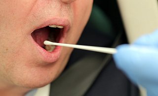 Der Abstrich für einen Test erfolgt mit einem sterilen Wattestäbchen. - (Symbolbild): Frank-Michael Kiel-Steinkamp