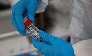 In Bielefeld gilt ab Dienstag eine neue Allgemeinverfügung. - Symbolfoto