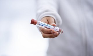 97 Neuinfektionen meldet der Kreis am Dienstag. - Pixabay
