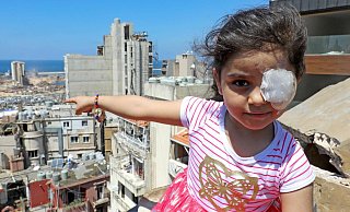 Dieses sechsjährige Mädchen hat bei der Explosion im Hafen von Beirut ihr linkes Auge verloren. 12 Tage später zeigt sie auf das völlig zerstörte Haus, in dem sie mit ihrer Familie bis zur Katastrophe lebte. - AFP or licensors