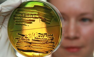 Eine Laborantin im Robert Koch Institut vergleicht eine biochemische Testung zur Unterscheidung von verschiedenen Arten von Durchfallerregern. - Matthias Bein/picture alliance/ZB