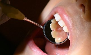 In einer Herforder Zahnarztpraxis wurde Zahngold geklaut. - Julian Stratenschulte/dpa