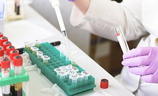 Ab sofort werden nicht mehr alle Neuinfektionen auf Mutationen überprüft. Damit sollen auch die Labore entlastet werden.  - Symbolfoto: Pixabay