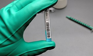 Wenige Infektionen sind registriert worden. - Pixabay (Symbolbild)