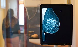 Wichtig für Frauen: Das Mammographie-Screening. - picture alliance / Klaus-Dietmar Gabbert/dpa-Zentralbild/dpa