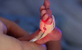 Frühgeborene, die weniger als 1.250 Gramm wiegen, dürfen künftig nur noch in drei Krankenhäusern in OWL versorgt werden. - picture alliance/dpa