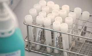 Die Zahl der positiven Tests sinkt weiter. - Pixabay