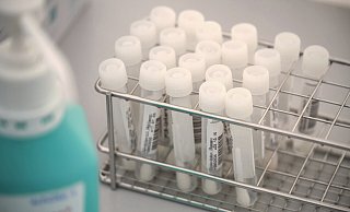 Die Auswertung beim Labor hat einige Tage gedauert. - THORSTEN ULONSKA