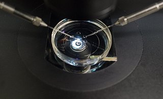 Die Patientin fühlte sich schlecht beraten und verklagte erstmal die komplette Praxis. - picture alliance / Klaus-Dietmar Gabbert/dpa-Zentralbild/dpa