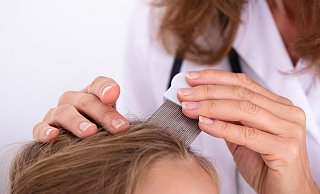 Kopfläuse sind im Kreis Paderborn wieder auf dem Vormarsch. Die kleinen Parasiten leben vor allem in Kinderhaaren, sorgen für Juckreiz und vermehren sich schnell. - AOK/hfr Kopfläuse sind im Kreis Paderborn wieder auf dem Vormarsch. Die kleinen Parasiten leben vor allem in Kinderhaaren, sorgen für Juckreiz und vermehren sich schnell. - AOK/hfr