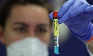 Ein PCR-Test darf vor Anpfiff nicht älter als 48 Stunden sein. Foto: Reuters - REUTERS