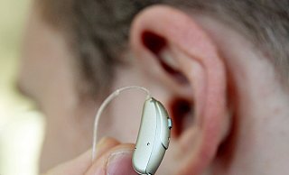 Ein Cochlea-Implantat kann Gehörlosen helfen, zu hören. Dafür ist allerdings viel Übung nötig und selbst dann ist der Klang nicht wie für einen "normal" hörenden Menschen. - Bernd Weissbrod/dpa
