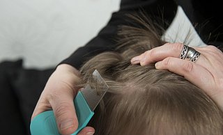 Kopfläuse sollten auf jeden Fall behandelt werden. In der Apotheke gibt es verschiedene Produkte, die von den gesetzlichen Krankenkassen übernommen werden. - AOK/colourbox/hfr Kopfläuse sollten auf jeden Fall behandelt werden. In der Apotheke gibt es verschiedene Produkte, die von den gesetzlichen Krankenkassen übernommen werden. - AOK/colourbox/hfr