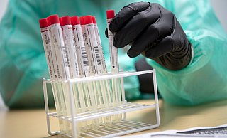 Jede Patientin und jeden Patienten wird im Johannesstift vor der stationären Aufnahme mit einem PCR-Test getestet. - Sina Schuldt