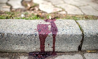 Das schwer verletzte Opfer konnte keine Aussage mehr zu der Attacke machen. - Verwendung weltweit