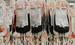 Weniger Menschen spenden Blut. Die Produkte sind so knapp, dass das Auswirkungen auf die Kliniken haben kann. - Susanne Barth
