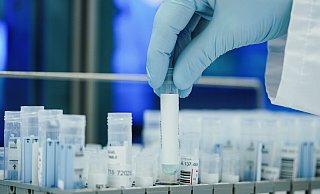 PCR-Tests sind zwar sehr aussagekräftig, werden aber immer seltener durchgeführt. - Uwe Anspach
