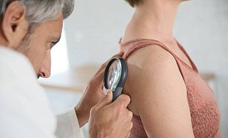 Die gesetzlichen Krankenkassen empfehlen und finanzieren Männern und Frauen alle zwei Jahre ein Hautscreening zur Früherkennung von Hautkrebs. - picture alliance