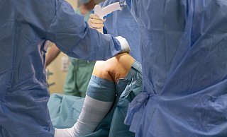 Das Einsetzen eines künstlichen Kniegelenks wegen Arthrose gehört zu den häufigsten Operationen in der Region. - picture alliance