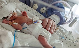 13 Wochen zu früh kam dieser Junge zur Welt. Er wurde von den Ärzten und Pflegekräften im Klinikum Herford rund neun Wochen lang rund um die Uhr betreut. - Klinikum Herford