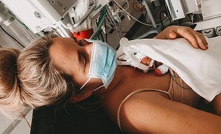 Hautkontakt zu den Eltern ist auch für Frühchen lebenswichtig. Hier liegt Ella kurz nach der Geburt auf dem Bauch ihrer Mutter Janina. - privat