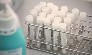 Auf Kanzlers Weide lassen sich laut Angaben der Mühlenkreiskliniken an den Wochenenden im Schnitt 1.400 bis 1.500 Menschen pro Tag testen, unter der Woche sind es täglich 600 bis 700. - (Symboldbild) Thorsten Ulonska