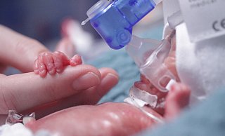 Sam wog bei seiner Geburt am 11. November 2022 nur 305 Gramm. - St.-Vincenz-Kliniken