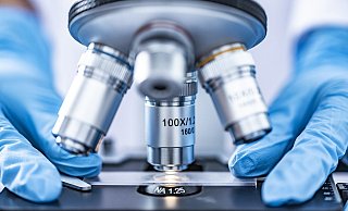 Für die DNA-Analyse sind mehrere Verfahrensschritte nötig. - Pixabay (Themenbild)