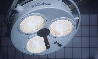 Die Ärzte glaubten eine Blutung im Bereich der Milz zu sehen und entfernten das Organ in einer OP. - Symbolbild: Pixabay