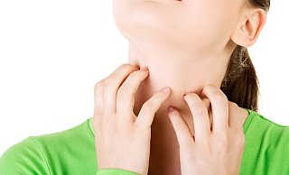 Die Anzahl der Krätze-Fälle ist in Bielefeld weiter gestiegen. Die Behandlung erfolgt mit Salben und gegebenenfalls auch mit Tabletten. - AOK/hfr.