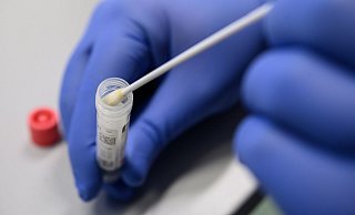 Ein Abstrich für das Testverfahren auf das Virus SARS-CoV-2. - picture alliance
