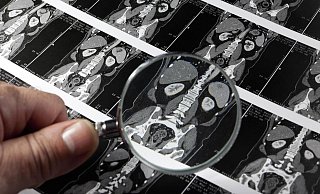 Fehler beim Befund: Zu diesem Urteil ist jetzt eine Zivilkammer des Landgerichtes Bielefeld gelangt. Dabei hatte es mehrere MRT-Untersuchungen gegeben. - picture alliance / imageBROKER