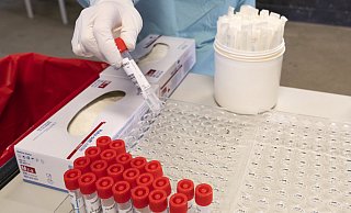 Fünf Prozent der positiven PCR-Proben werden auf die Zusammensetzung ihres Erbguts untersucht. - Picture alliance / NurPhoto | Joaquin Gomez Sastre