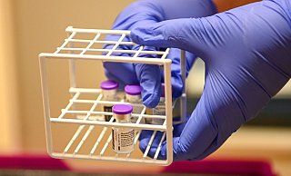 Der Impfstopp bei Astrazeneca hat zu großer Verunsicherung geführt. Bielefelder Mediziner raten hingegen zu Besonnenheit und empfehlen, sich später weiter mit dem Vakzin impfen zu lassen. - Christian Weische