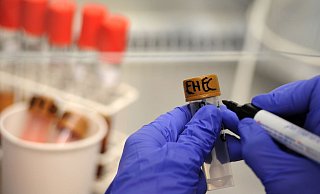 Schimmel, Salmonellen, zu viel Chrom VI: regelmäßig werden in NRW Produkte zurückgerufen. - Christian Charisius/dpa