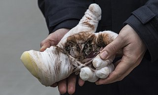 Beim Zünden legaler Böller kann es zu schweren Verletzungen kommen, wie dieses Handmodell der Feuerwehr zeigt. - picture alliance / Paul Zinken/dpa
