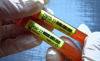 In der Stadt könnten mehr Corona-Tests durchgeführt werden. - picture alliance / SvenSimon