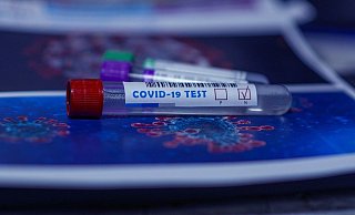 Das Gesundheitsamt kann nicht sagen, wie viel getestet wird. - Symbolfoto: Pixabay