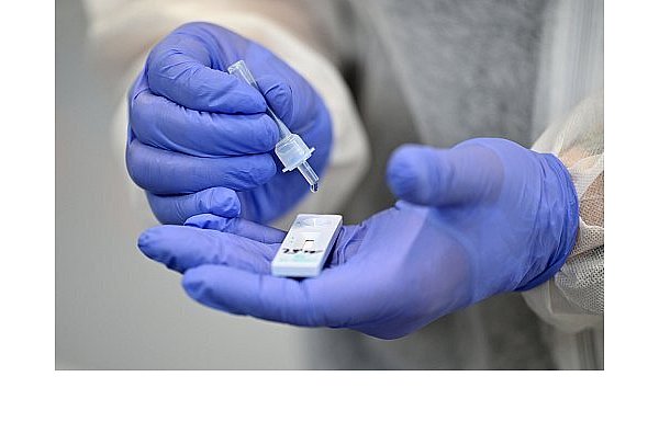 Die Untervariante KP.3 ist sehr ansteckend. - © dpa