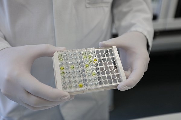 96 Proben, davon weisen 14 Antikörper auf - was durch die Gelbfärbung deutlich wird. - © Nicole Sielermann