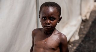 WHO: Mpox-Ausbruch weiter gesundheitliche Notlage